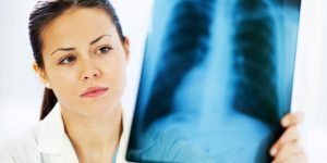 Mai puține cazuri de tuberculoză în județul Mureș