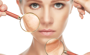 Ce spun dermatologii despre depistarea precoce a cancerului de piele