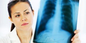 A scăzut numărul cazurilor de tuberculoză în județul Mureș
