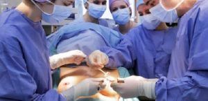 Mastectomie bilaterală şi reconstrucţie mamară concomitentă la Spitalul de Urgenţă