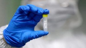 Un nou caz de coronavirus în România