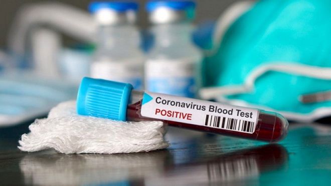 S-a anunțat localitatea natală a celui de-al treilea mureșean infectat cu coronavirus!