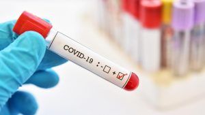 Ratele de incidență COVID-19 din Mureș