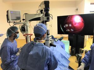 Noutăți importante în domeniul chirurgiei oftalmologice la Dora Optics
