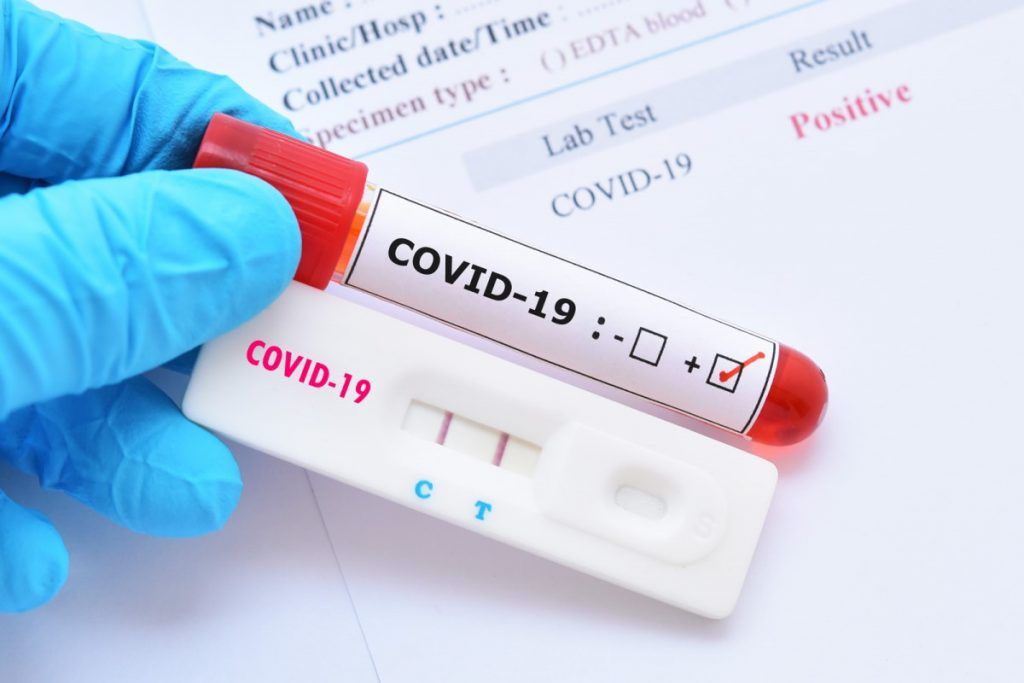 Puține cazuri noi de COVID-19 în Mureș