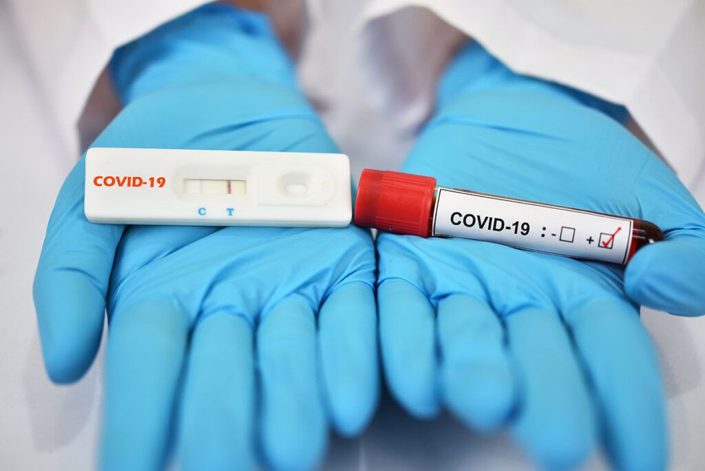 Info COVID-19 Mureș: teste, internați, cazuri noi