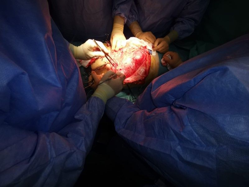 Tumoră gigant operată la Spitalul de Urgenţă Târgu Mureş